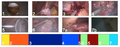 Grid of images with steps from surigical procedure.